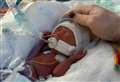 Parents praise hospital after 'rollercoaster' birth of 1.5lb baby