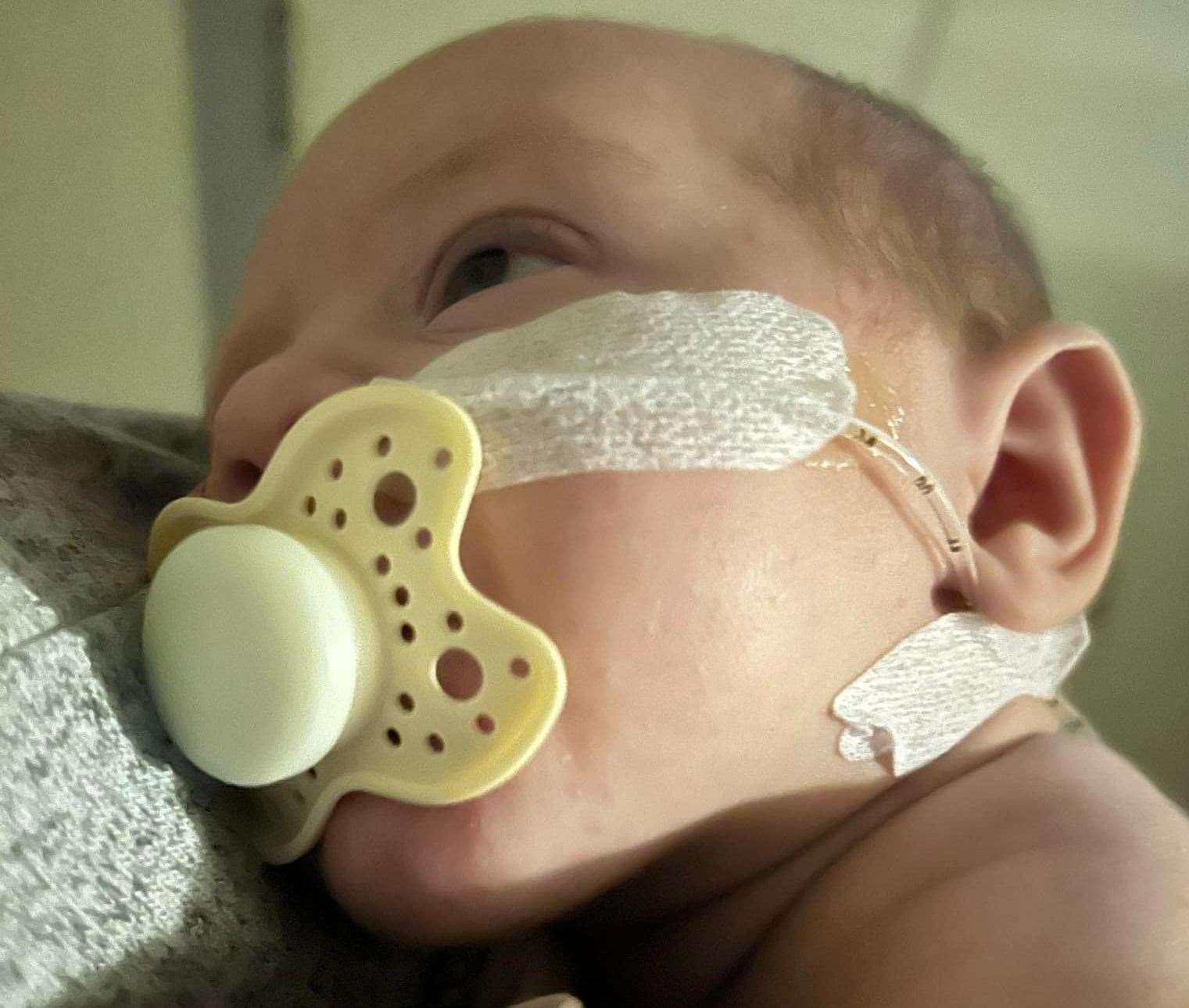 Baby Autumn was diagnosed with respiratory syncytial virus