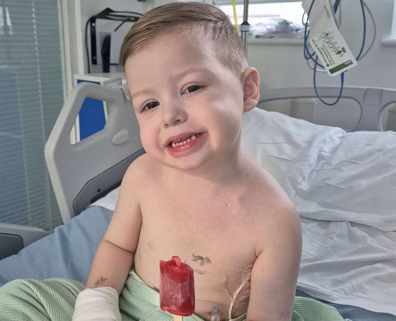 Henley Mountford-Farmer, five, was born with gastroschisis. Picture: SWNS